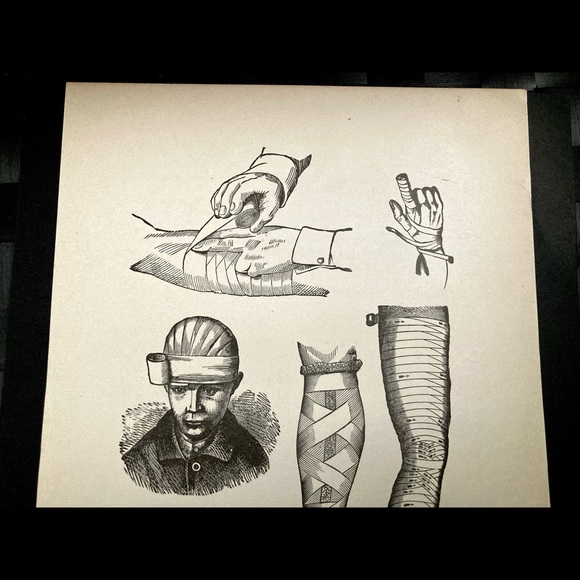 Vintage Medical Diagram | Bandages | Circa 1903 - Picture 3 of 6